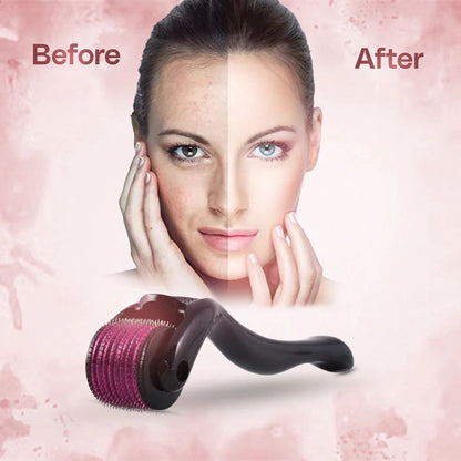 Derma Rollers